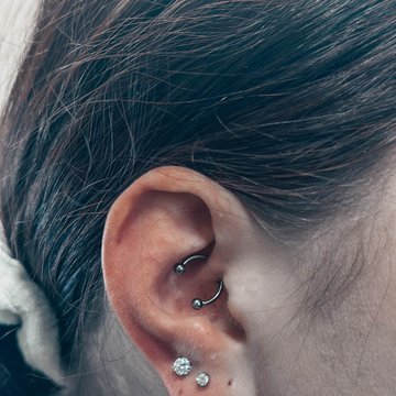 photo-3